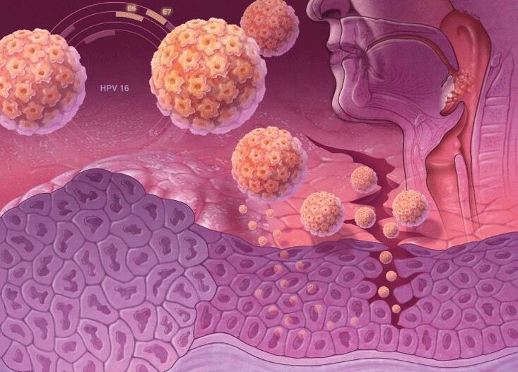 Pătrunderea HPV în corpul uman