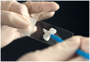 Testul pap pe papilomavirus uman infecție